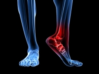 Where Heel Pain Can Come From