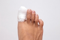 What to Know About Broken Toes 