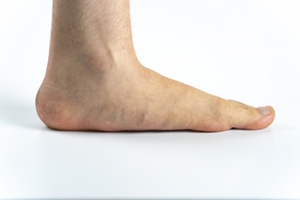 Do Flat Feet Hurt?