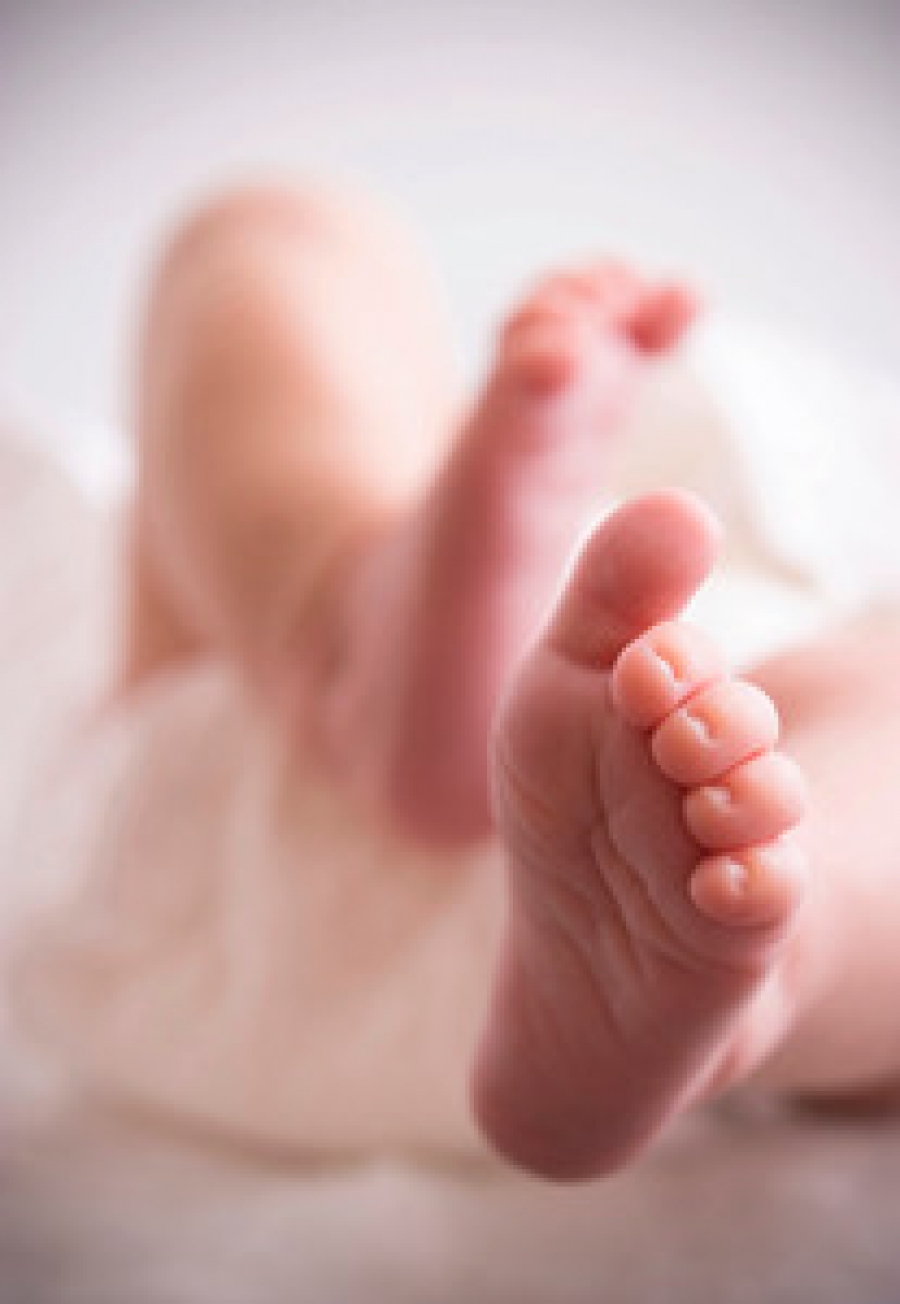 Is Clubfoot Considered Curable Is Clubfoot Considered Curable