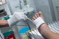 The Danger of Diabetic Foot Ulcers